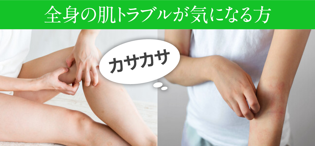 全身の肌トラブルが気になる方